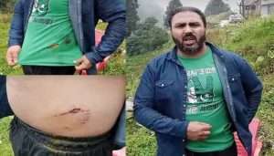 گلیات میں خونخوار چیتے نے نوجوان کو زخمی کر دیا