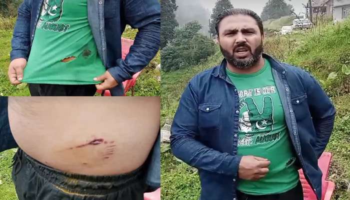 گلیات میں خونخوار چیتے نے نوجوان کو زخمی کر دیا