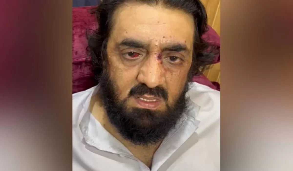 دھماکے میں زخمی حافظ حمد اللہ کا بیان سامنے آگیا