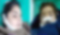 چمنکہ،زہریلے سیب کھانے سے 2 بچے جاں بحق،4 کی حالت تشویشناک