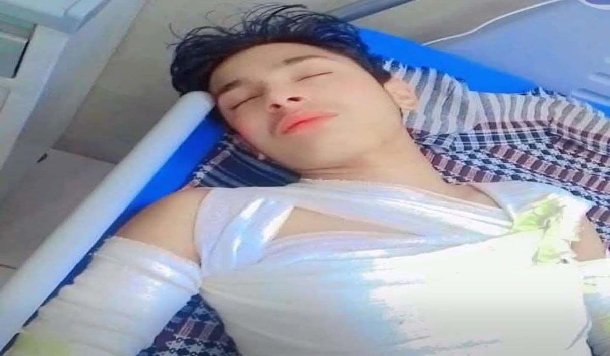 مری،ڈکیتی کے دوران جلایا گیا نوجوان جان کی بازی ہار گیا